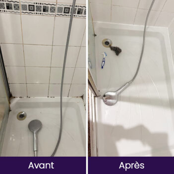 NuroClean image